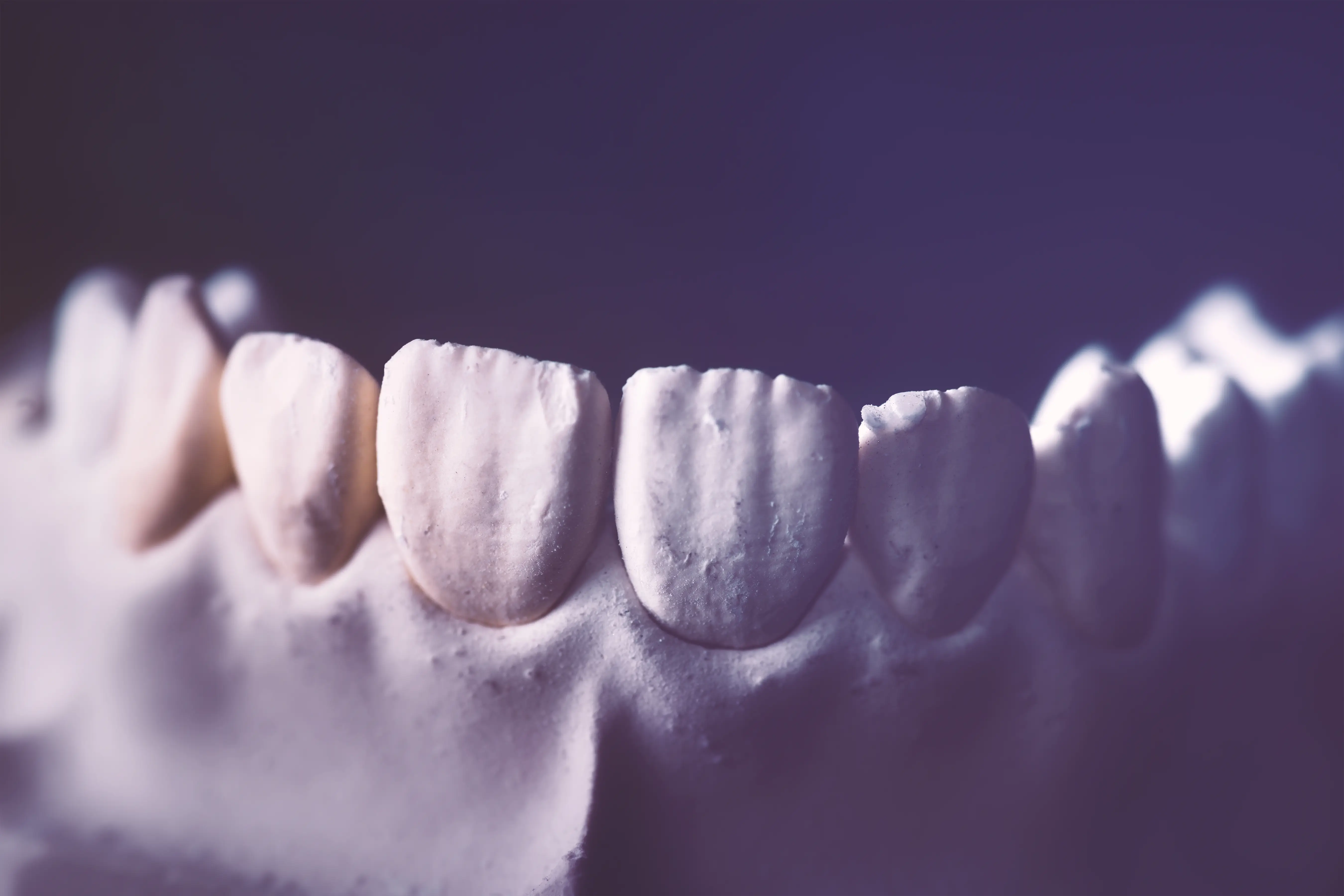 Prothèses dentaires